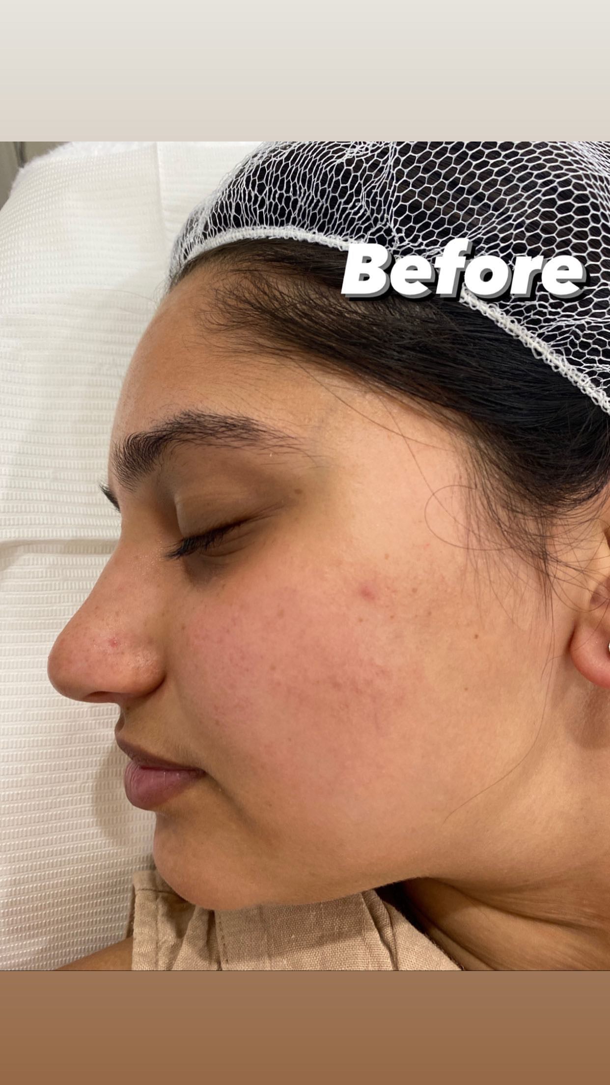 Glass Skin Professional Peel Kit