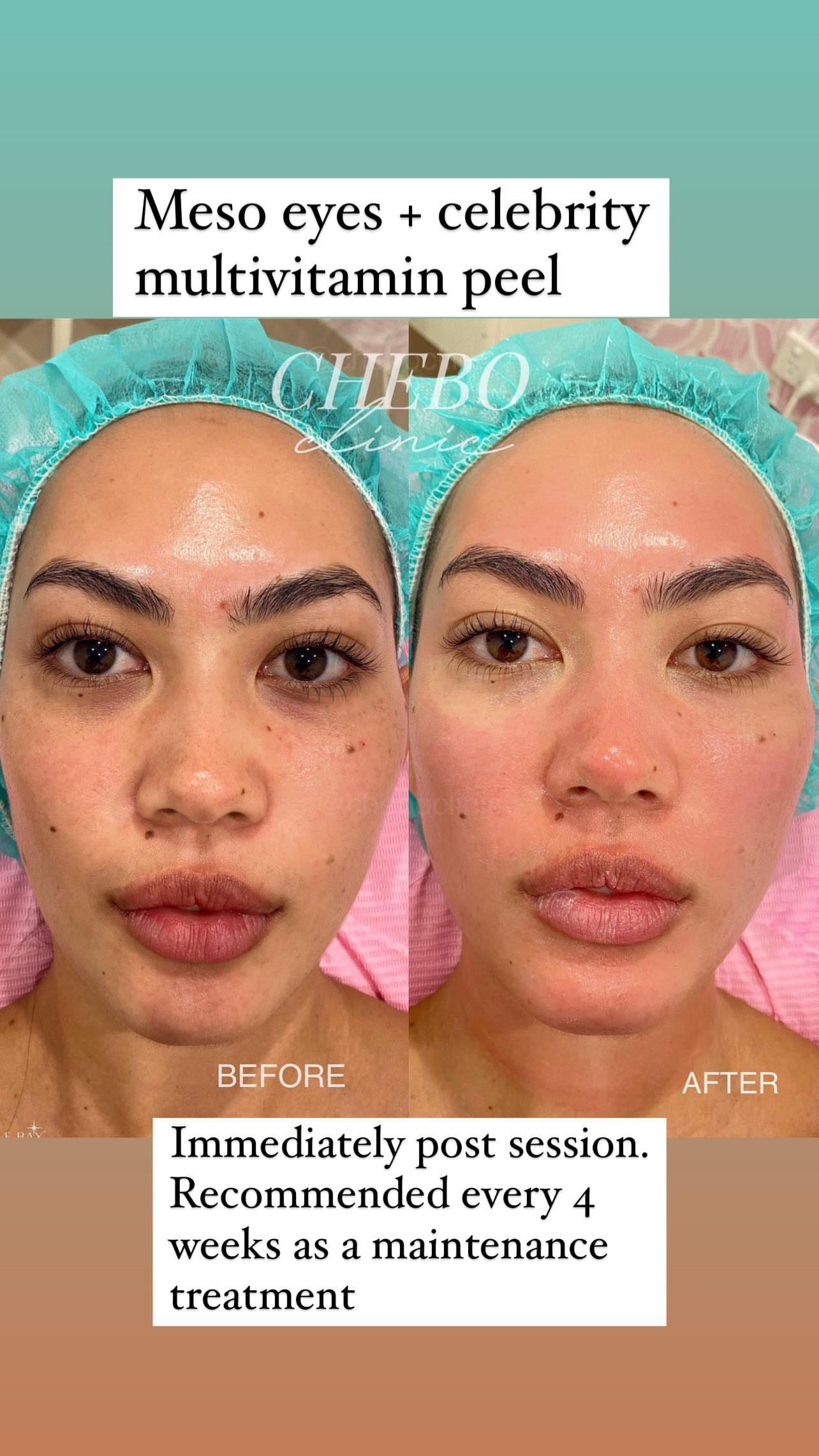 Glass Skin Professional Peel Kit