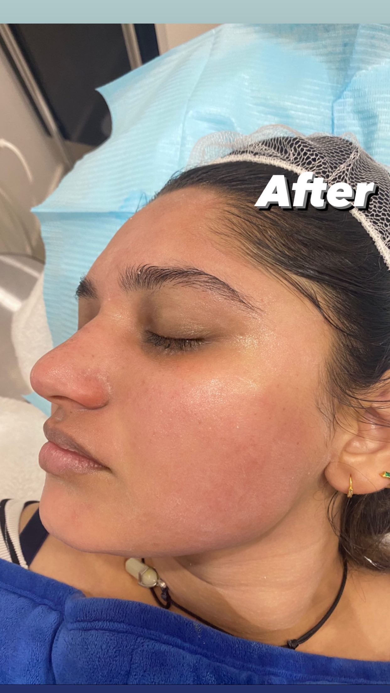Glass Skin Professional Peel Kit