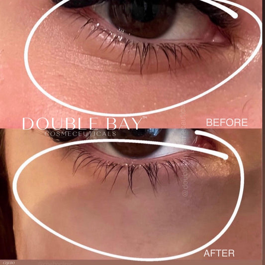 Hero Lifting Eye + Nasal fold + Neck Intensive Wrinkle Cream 50g