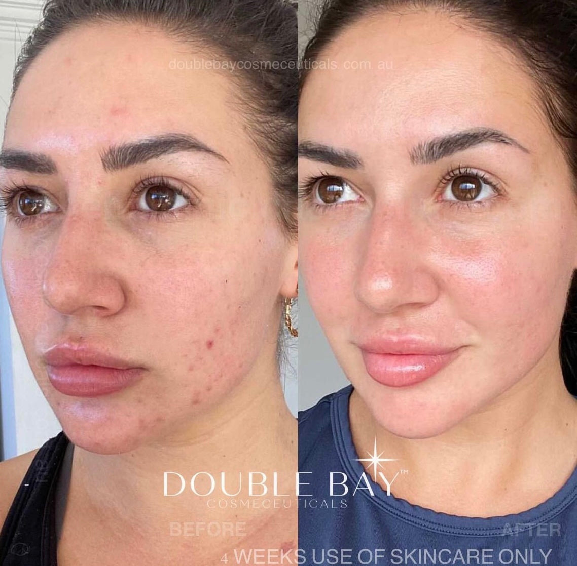 Beginner Glass Skin Bundle- Dry Skin Type - Full Size