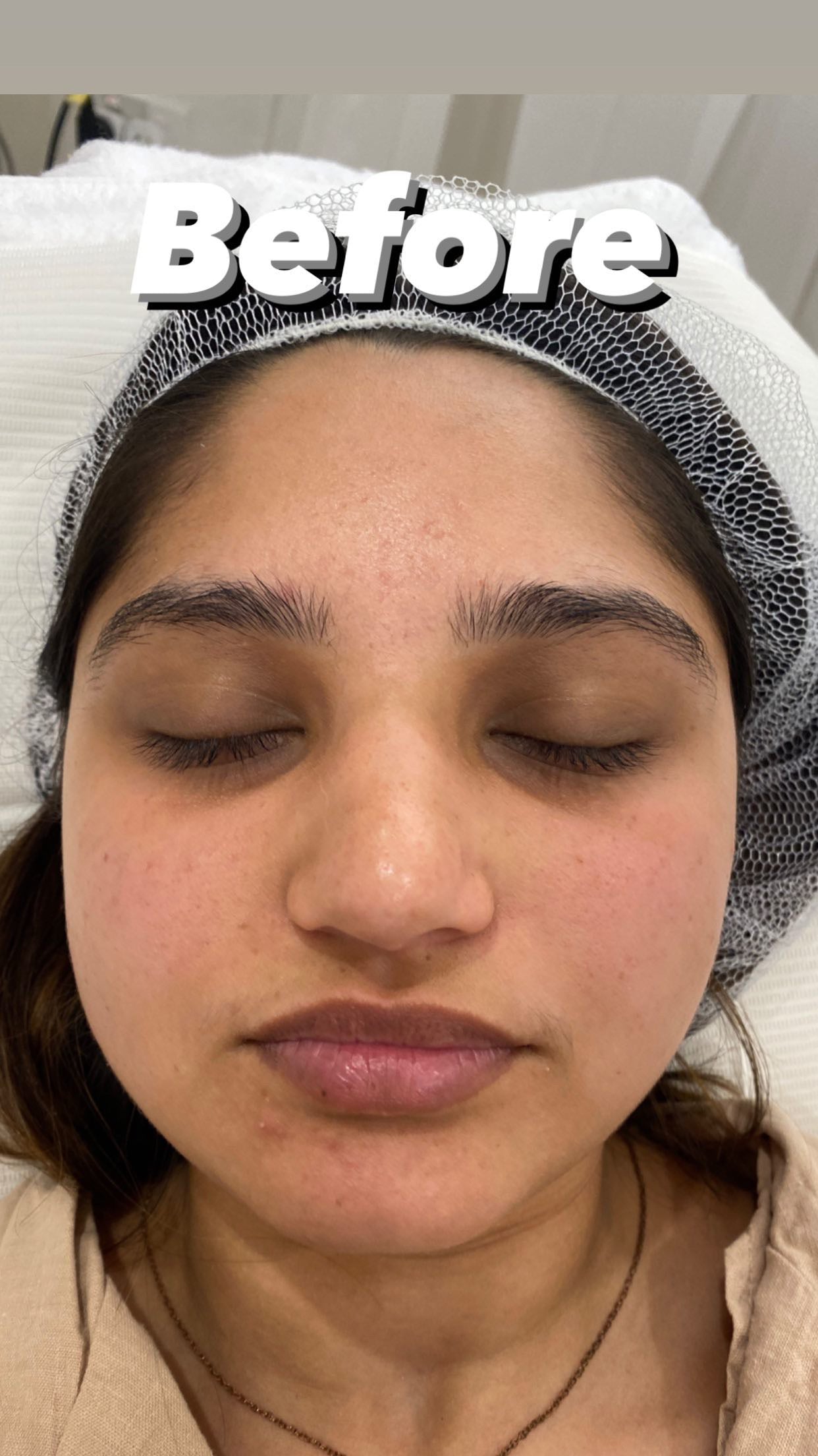 Glass Skin Professional Peel Kit