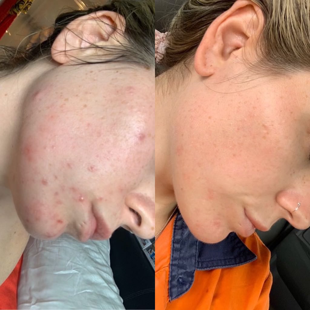 Hero Ectoin 1% + Saffron 1% Super Serum Baby 20ml
