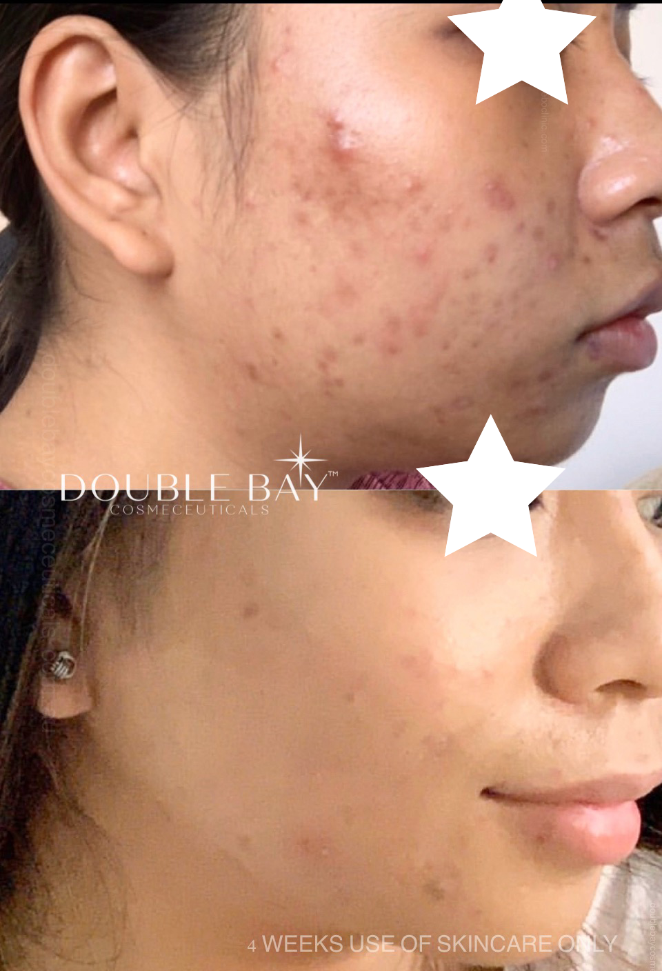 Resilient Pigment+Texture 3x T-Sinase Serum Baby 20ml