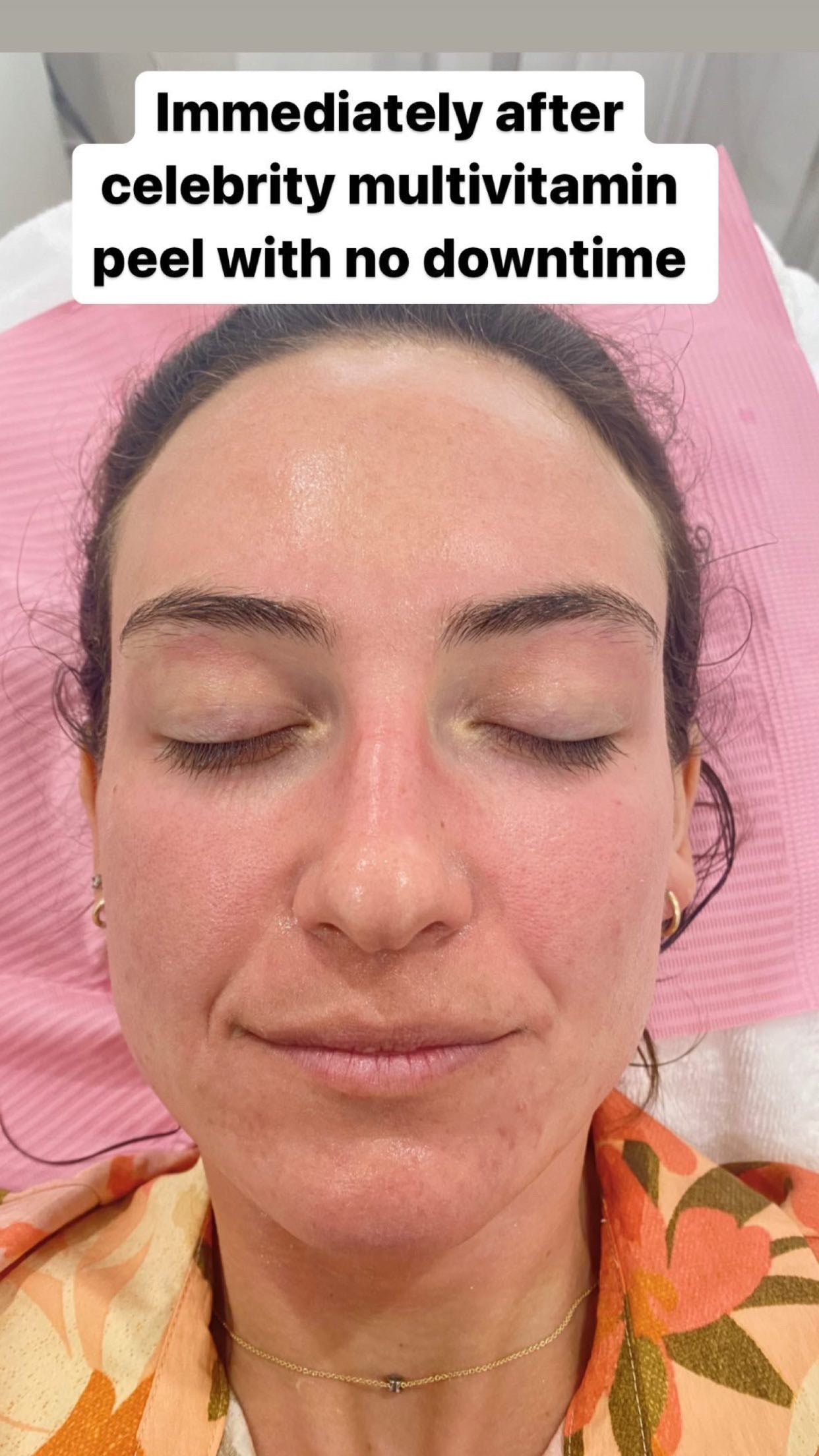 Glass Skin Professional Peel Kit