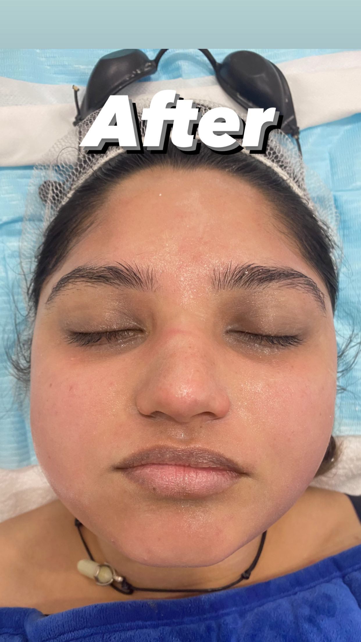 Glass Skin Professional Peel Kit