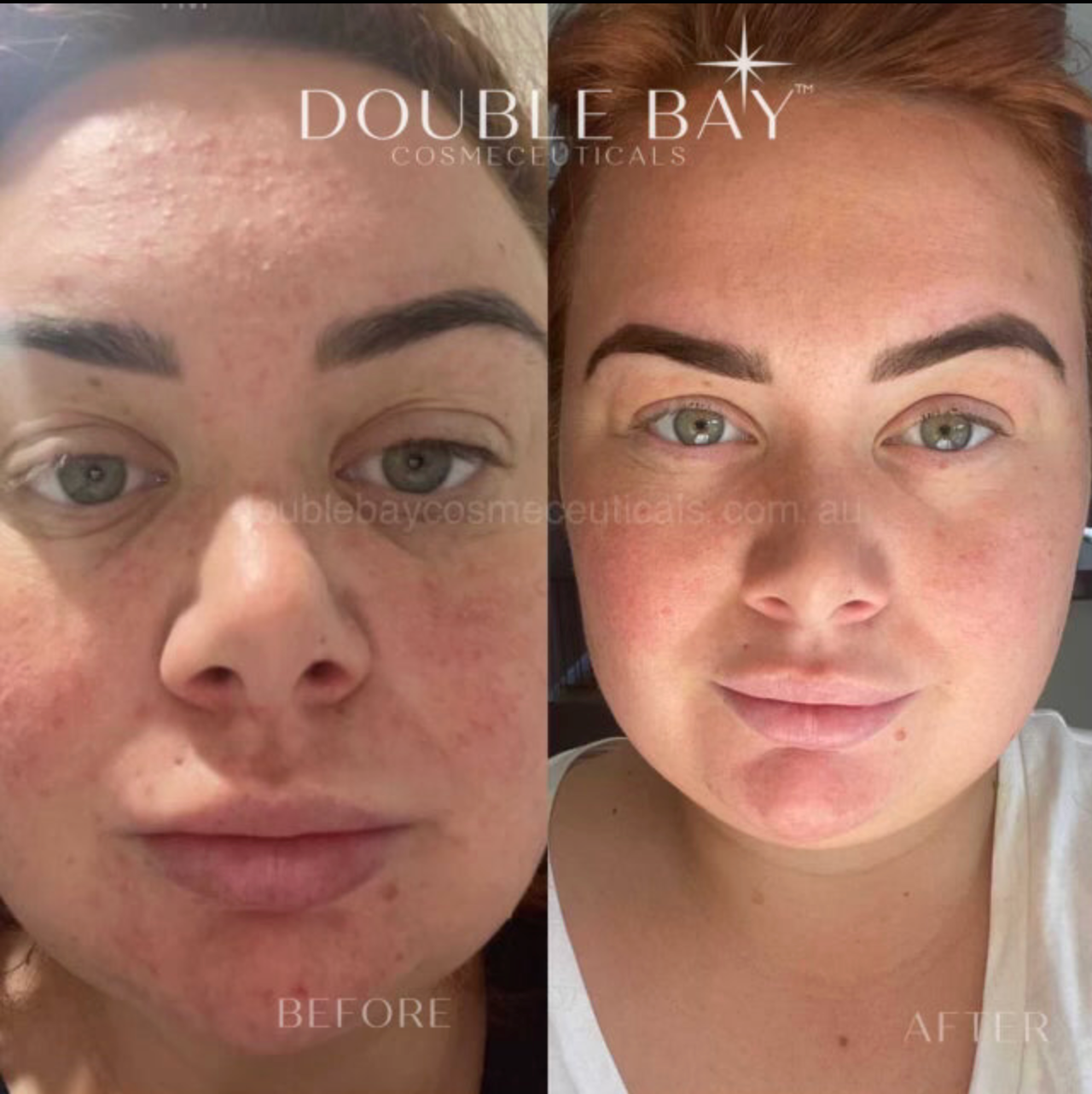 Magical Clinical Calming Peel Cream