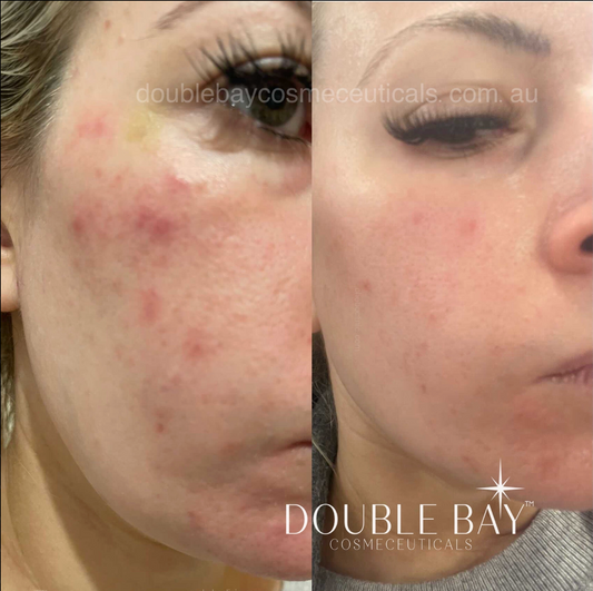 Reset Resurfacing Brightening Night Cream 30ml