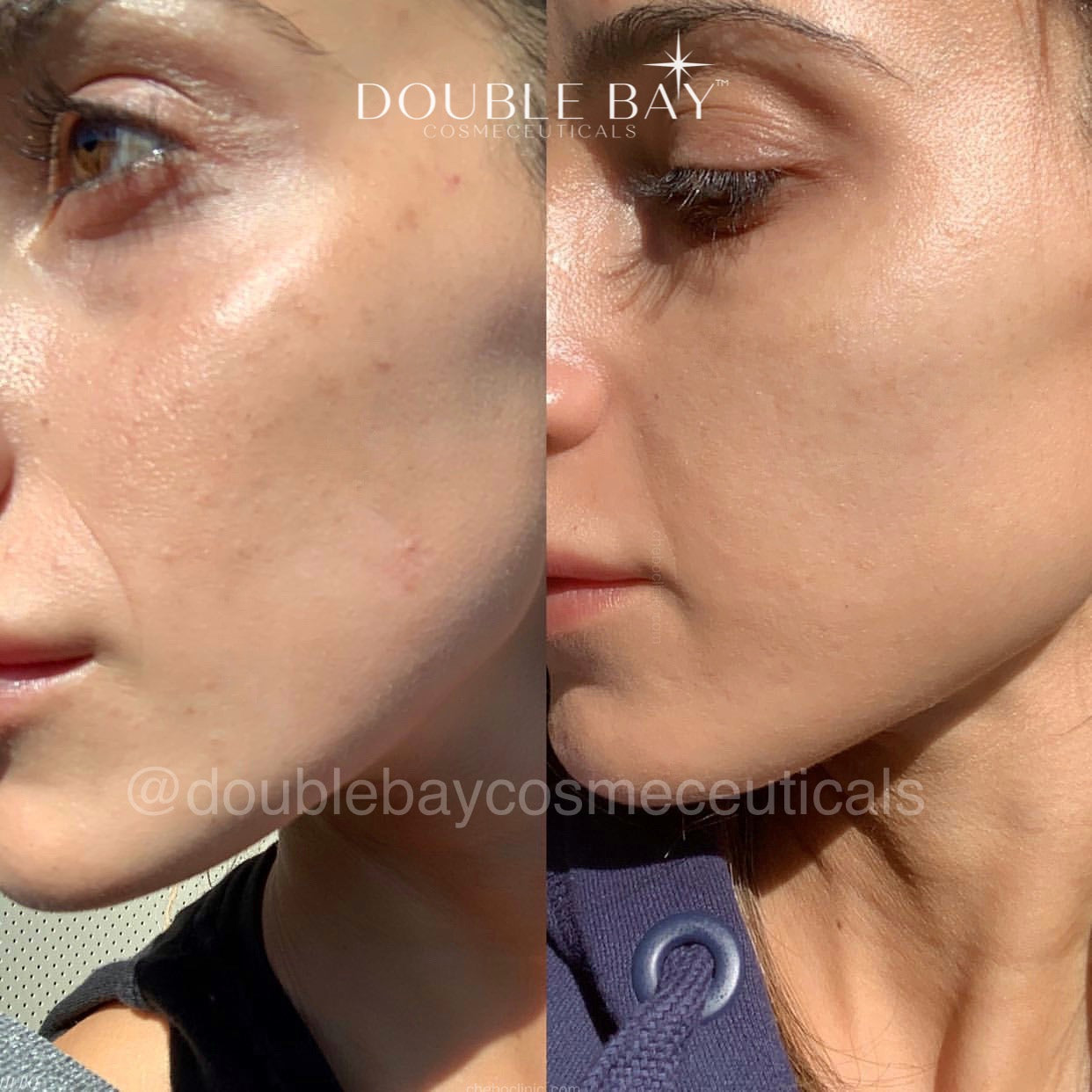 AHA Toner results