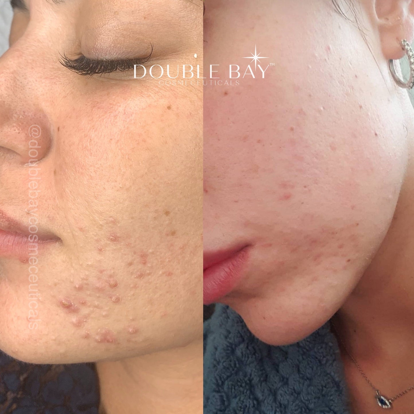 Encapsulated Retinol 1% Concentrate Serum 20ml