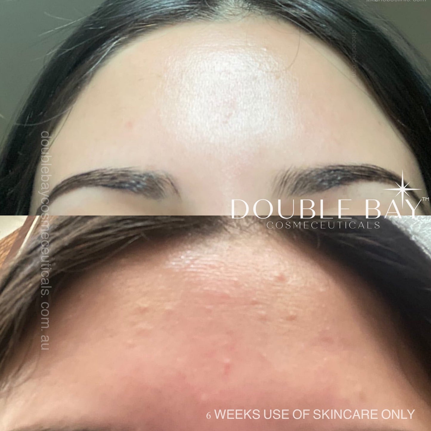 Encapsulated Retinol 1% Concentrate Serum 20ml