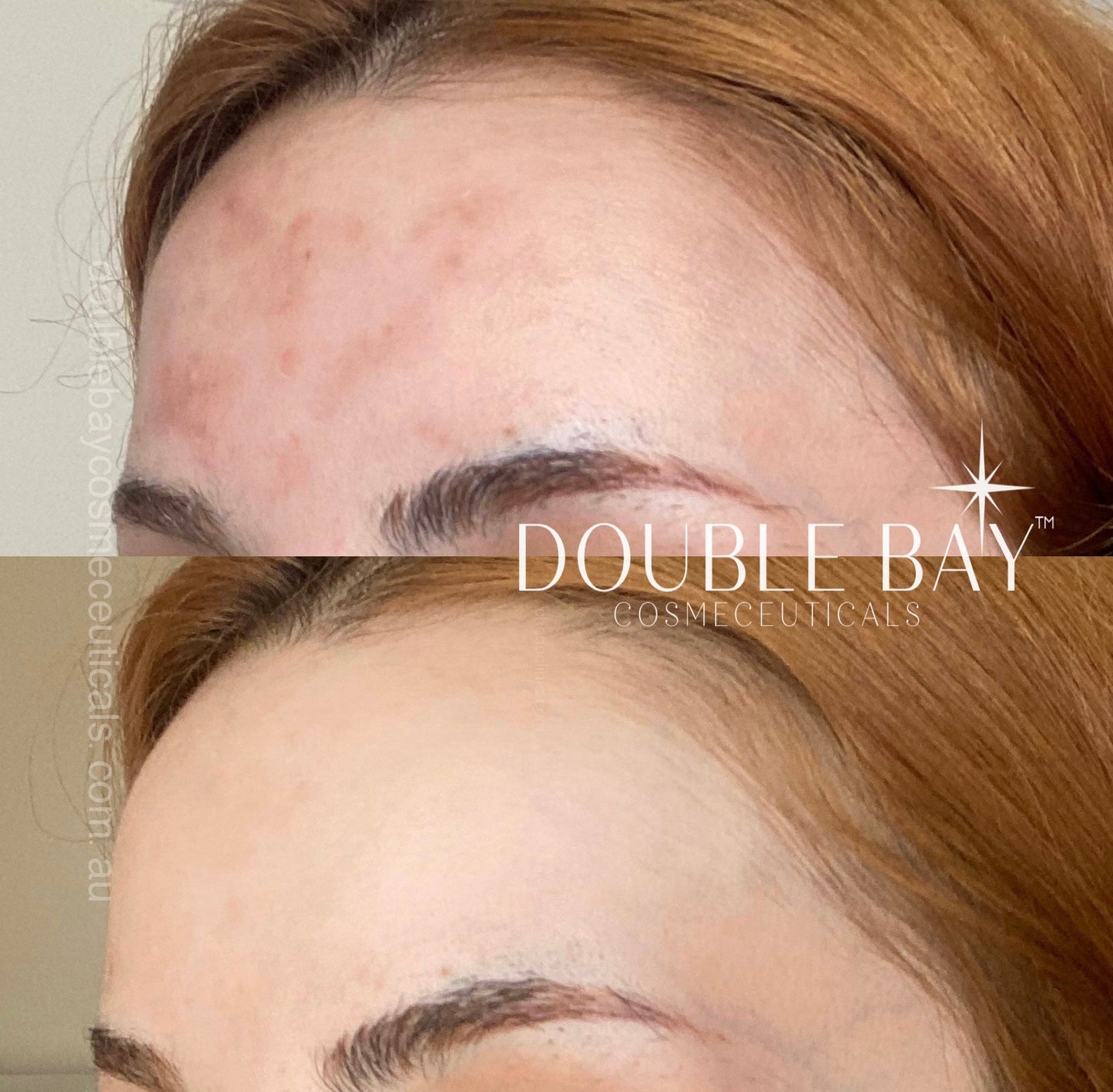 Ubiquinone 2% + LicoriBright Cream