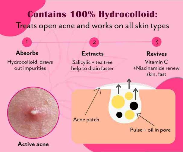 Pimple Patches