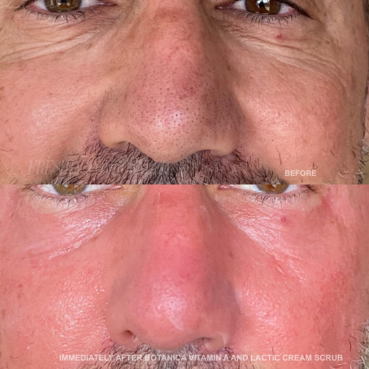 Botanica Vitamin A + Lactic Acid Cream Scrub