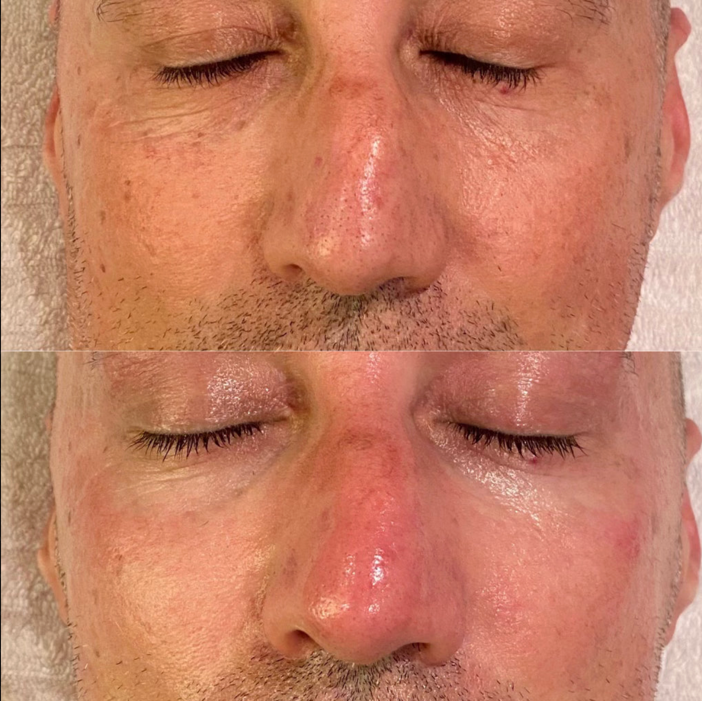 LICORILACTIC LUMINI PEEL