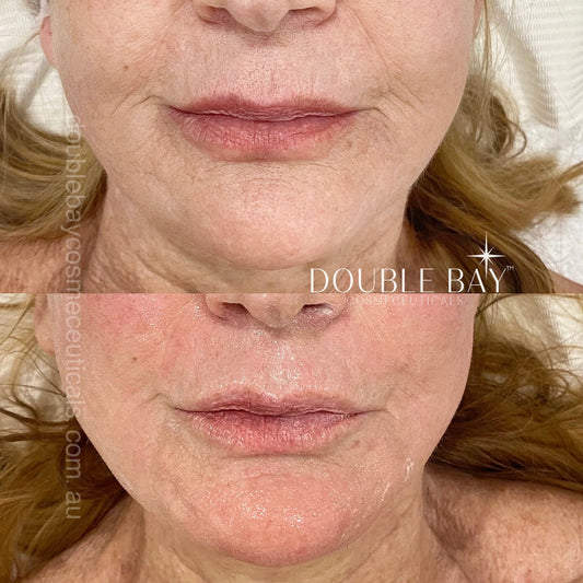 Intense Copper Binding GHK-Cu 5% +Palmitoyl Oligopeptide 0.3% Repair Serum 100ml
